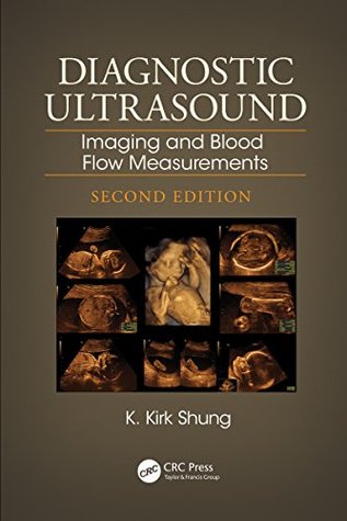 Download Diagnostic Ultrasound: Imaging and Blood Flow Measurements, Second Edition - K Kirk Shung file in PDF