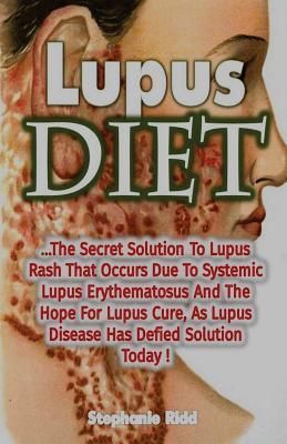 Read Online Lupus Diet: The Secret Solution to Lupus Rash That Occurs Due to Systemic Lupus Erythematosus and the Hope for Lupus Cure, as Lupus Disease Has Defied Solution Today! - Stephanie Ridd | ePub