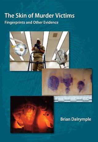 Read Online The Skin of Murder Victims: Fingerprints and Other Evidence - Brian E. Dalrymple | ePub