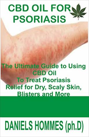Full Download CBD OIL FOR PSORIASIS: The Ultimate Guide to Using CBD Oil To Treat Psoriasis Relief for Dry, Scaly Skin, Blisters and More - Daniels Hommes file in PDF