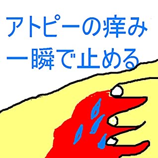 Download atopiseihifuennshishinnoturaikayumiitamiwoixtusyundetomeruhouhou: atopinoturaibetabetabetashinsyutuekiwoichinichidetomeru (seishinsyuxtupan) - shiryokukaifukukaifu | ePub